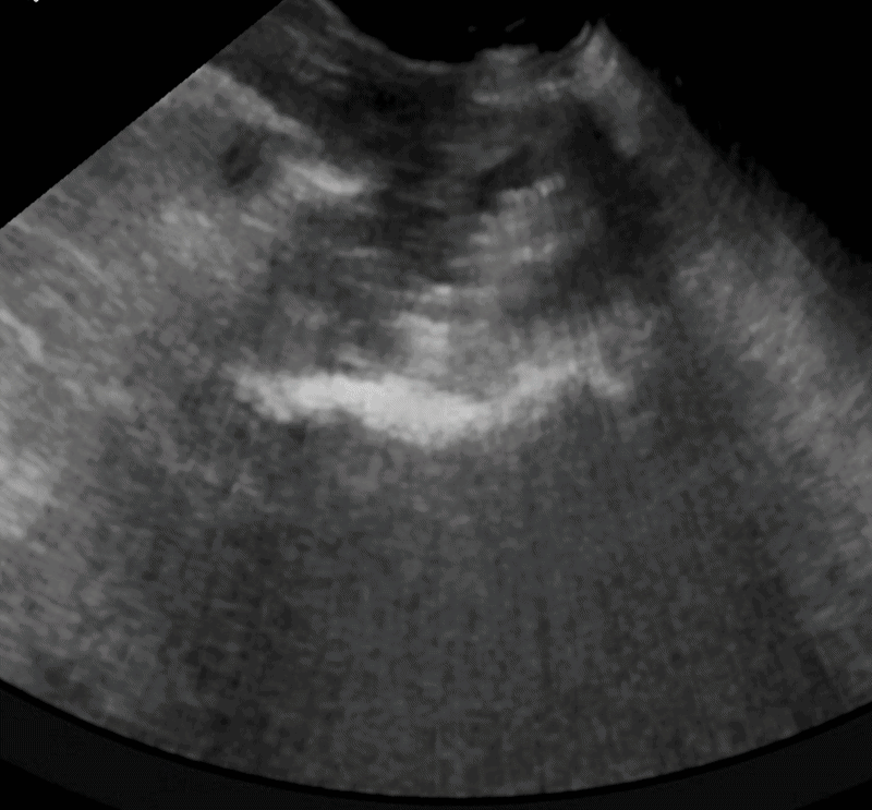 CUS knee scan pre-physiotherapy